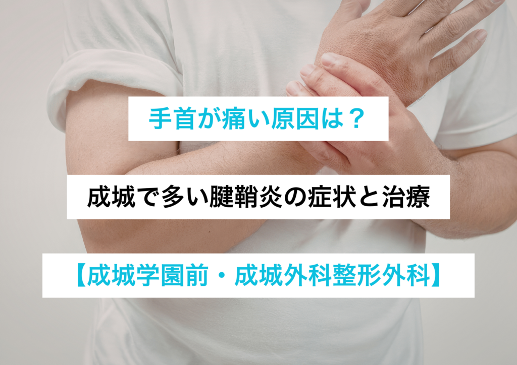 手首が痛い原因は?成城で多い腱鞘炎の症状と治療